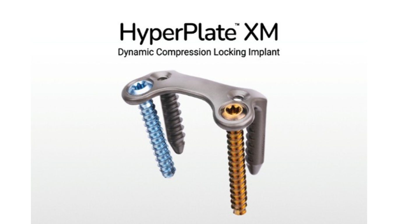 Treace Announces First Surgical Case with the HyperPlate™ XM Dynamic Compression Locking Implant System