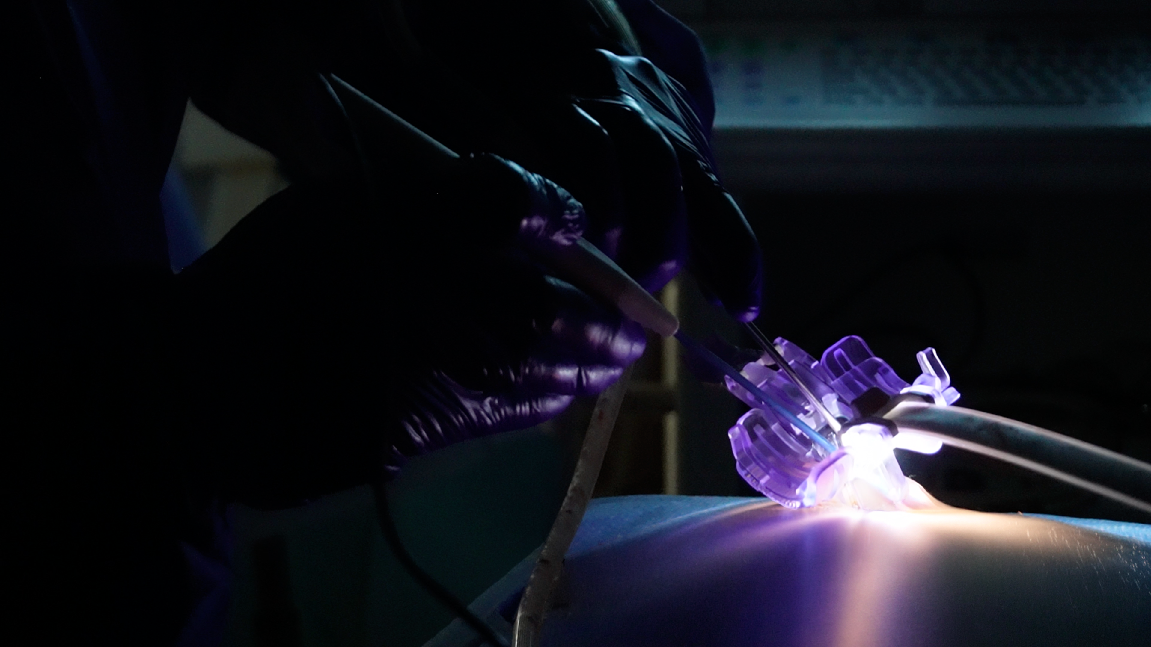 Neo Medical Introduces Instant MIS Access™: A New Platform Designed to Address the Operational Barriers Limiting Minimally Invasive Spine Surgery