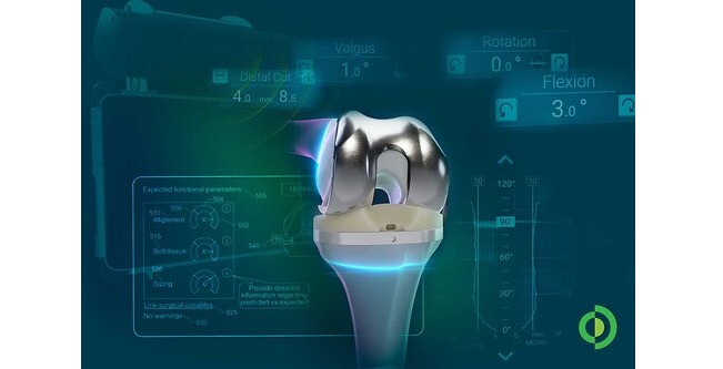 Advita Ortho Expands Scientific Evidence Advancing the Future of Predictive Planning for Total Knee Arthroplasty