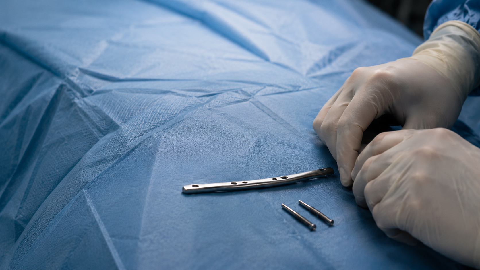 Modified INFIX Technique Promising for Pubic Symphysis Diastasis