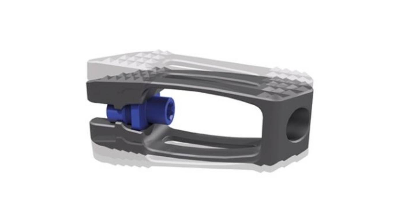 SIGNUS USA® Marks Major Milestone with First U.S. Surgery Using VertaConnect® Expandable Lumbar Spine Implant