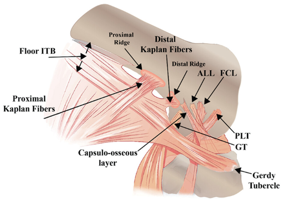 Are Kaplan Fibers the Missing Piece in ACL Rotational Instability?