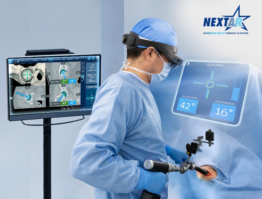 Medacta Introduces NextAR Hip Application to its Proprietary Augmented Reality Platform for Accurate and Efficient Execution of Personalized THA