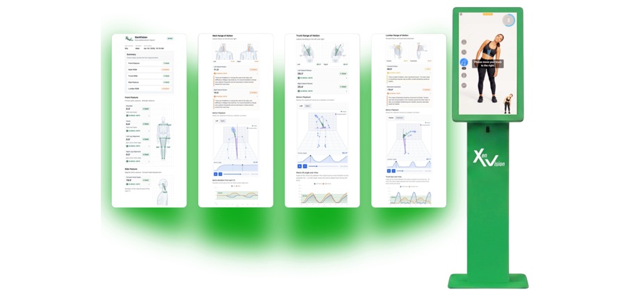From X-Rays to AI Vision: Meet XenVision