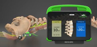 Alphatec Recalls SafeOp Interfaces Over Intraoperative Monitoring Interruptions