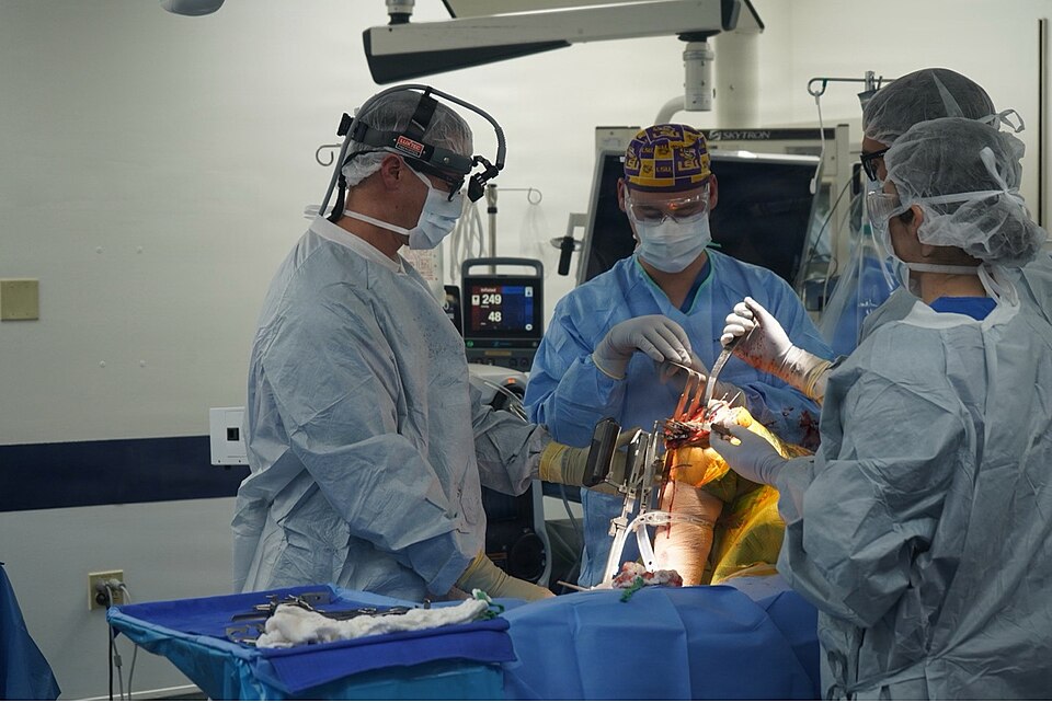 Outpatient Knee Arthroplasty: 2.1 Million Cases by 2040
