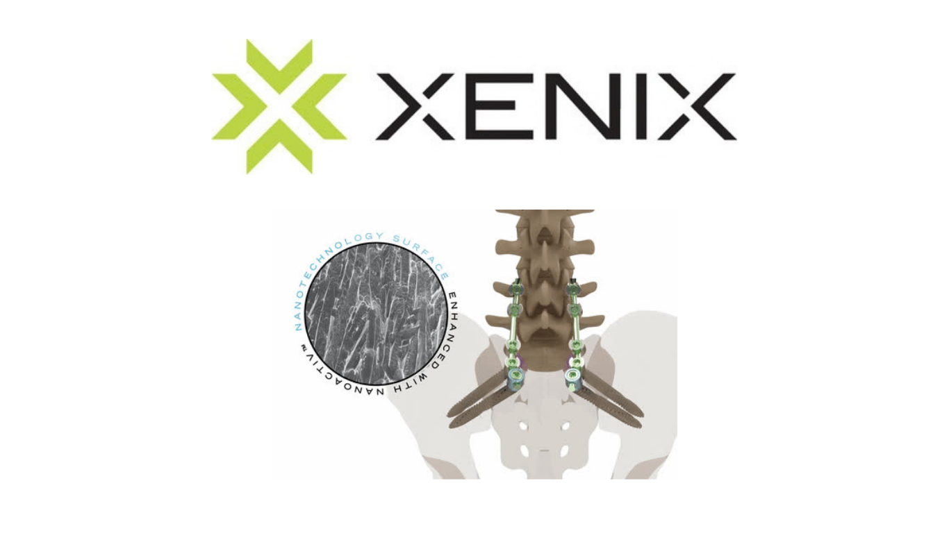Xenix Medical Announces FDA Clearance of the Riva® Anchor Spinopelvic Fixation System with NanoACTIV™ Surface Technology