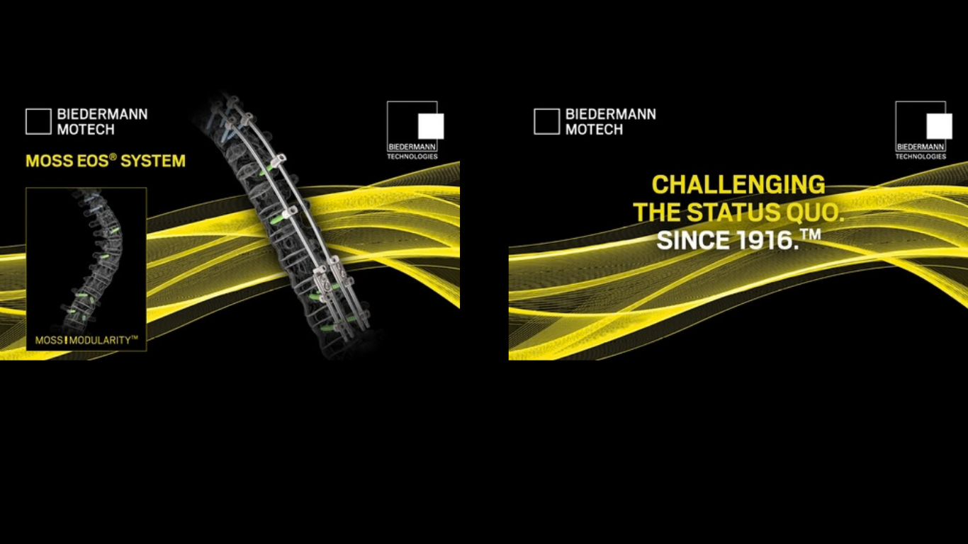 Worldwide First: Biedermann Motech Further Expands its MOSS!MODULARITY Platform with the Addition of MOSS EOS for Early Onset Scoliosis Surgery