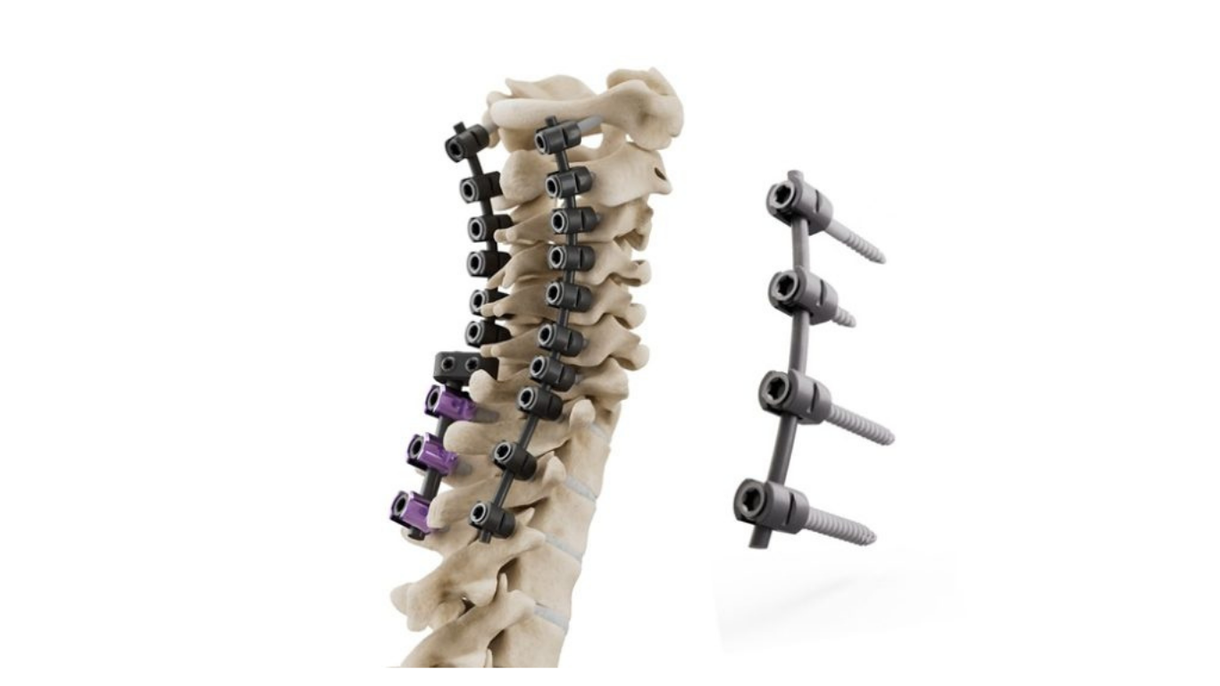 icotec Receives CMS approval for New Technology Add-On Payment for its CMORE® CT System