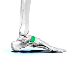 Müller-Weiss Disease: The Heel Has Other Ideas