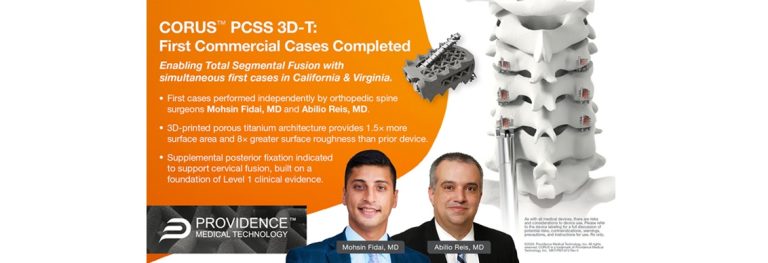 Providence Medical Technology Announces First Commercial Cases Using Next-Generation, 3D-Printed CORUS™ Posterior Cervical Stabilization System (PCSS 3D-T)