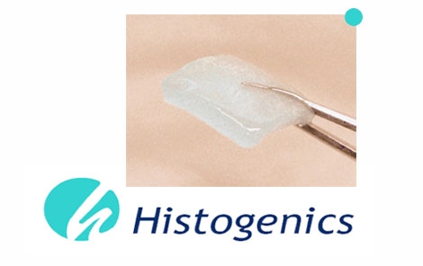Histogenics Lands $49 Million Cartilage Financing