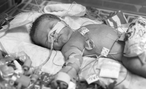 Advancing Pediatric Clinical Trials