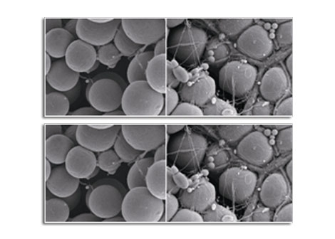 Adipose Stem Cells and Musculoskeletal Healing