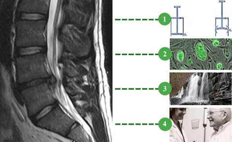 Regenerating the Spine in FOUR Steps
