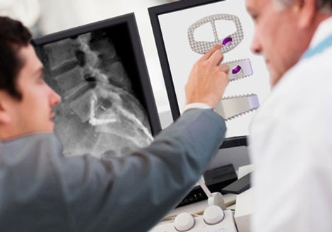 Spinal Elements Tests New LumbarSystem