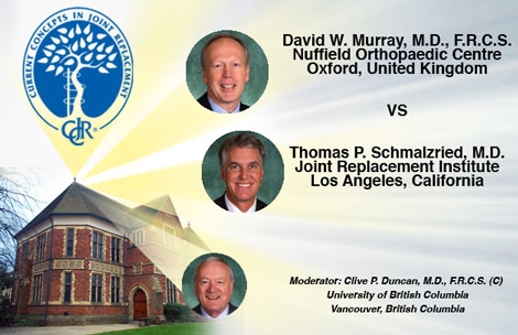 Houston Do we Have a Problem With Metal – Metal Pseudotumors? Murray