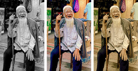 93-Year-Old Gets New Knees