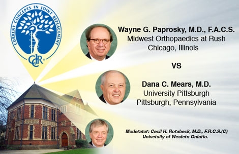 Paprosky vs. Mears: MIS Hype or Help?