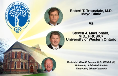 Squeaking Hip Replacements: Trousdale Debates MacDonald