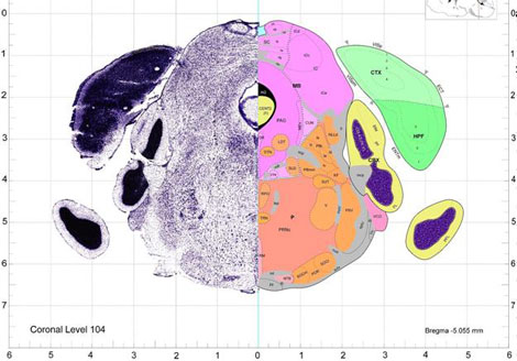 Head Trauma Speeds Up Brain Aging