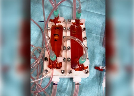 New Hope for Meniscus Tear Repair