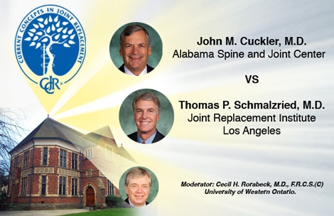 Cuckler Debates Schmalzried Over the Optimal Metal-Metal Arthroplasty