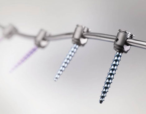 DePuy Synthes Spine Gets First FDA Nod