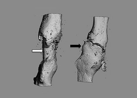 Revolutionary Bone Graft Coating