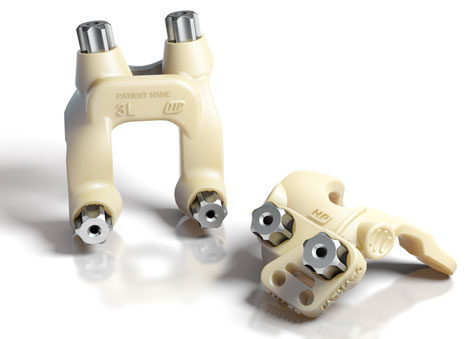 DePuy’s Personalized Knee Adds Options