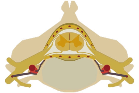 Stem Cells Injected Into Spinal Cord