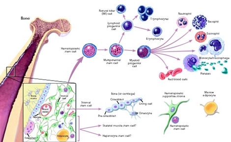 Stem Cell Powered PEEK Implant Coming