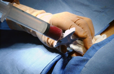 The Work of the Musculoskeletal Tumor Society