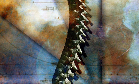 Spinal Motion Preservation: Update and Outlook—(Part 1 of 3)