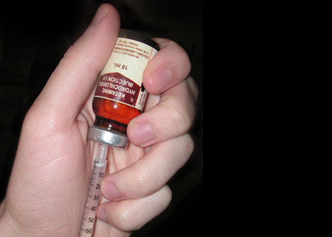 Steroid Injections Leading to Fractures?
