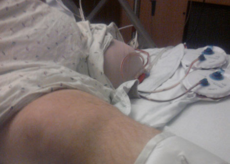 Leg Amputations Show Dramatic Decline