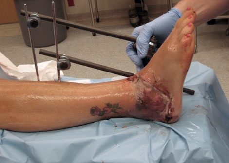 Scalpel…Now or Later?