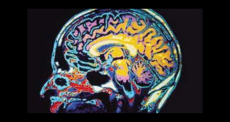 The Rise of the Concussion