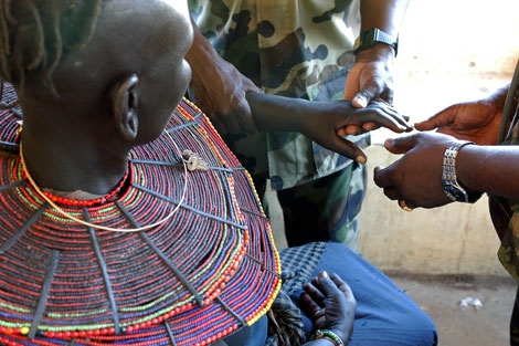 Trauma Care in the Developing World