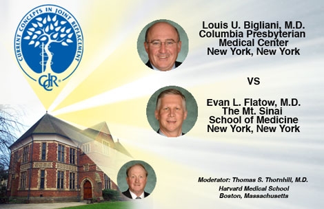 Orthopaedic Crossfire®: Bigliani vs. Flatow in Fracture Debate
