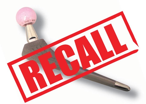 Stryker Hip Stem Recall Raises Warnings