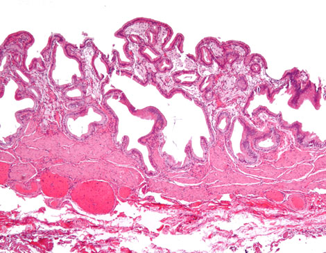 Yet Another Stem Cell for Bone Growth