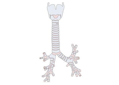 Child Gets Stem Cell Trachea