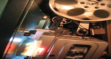 New Film Educates Spine Patients