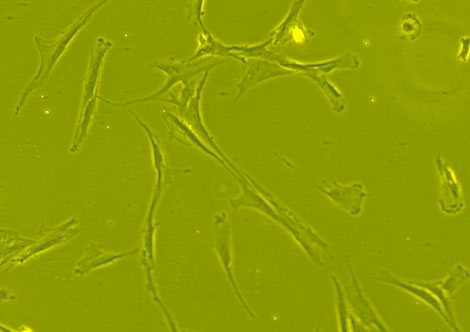 Sorting Hype From Fact in Stem Cells