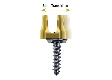 Biomet Spine Proclaims “Game Changing” Screw Technology