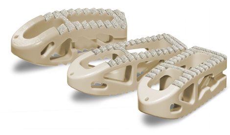 Spinal Elements Launches Unique Titanium Coated PEEK Implant