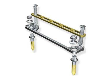 German Firm Introduces Spinal Implant