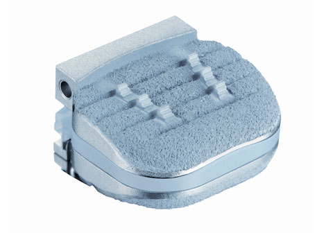 NuVasive’s Cervical Disc Approved