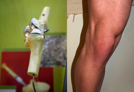 Knees: Just the Facts, Doc